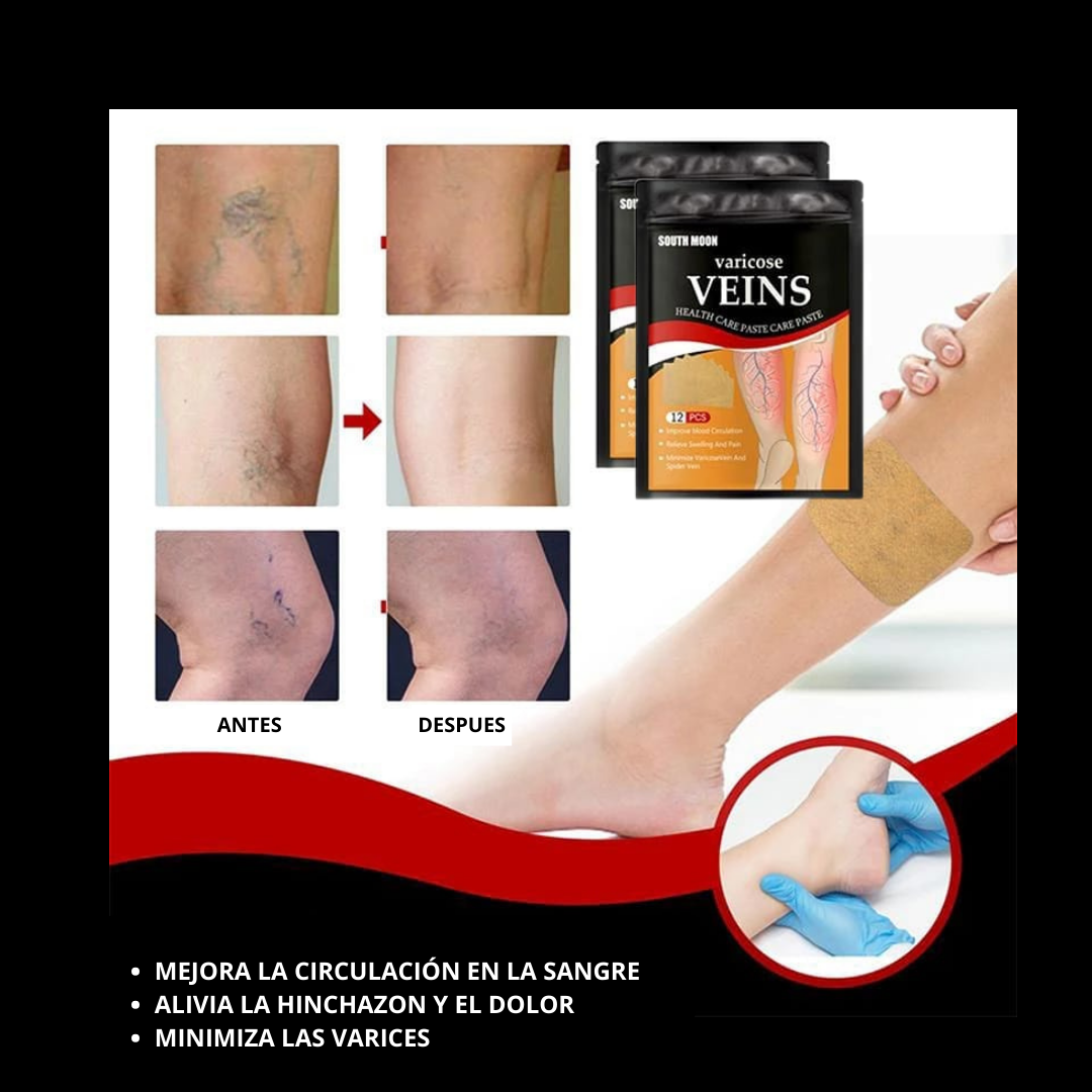 Parches para Varices