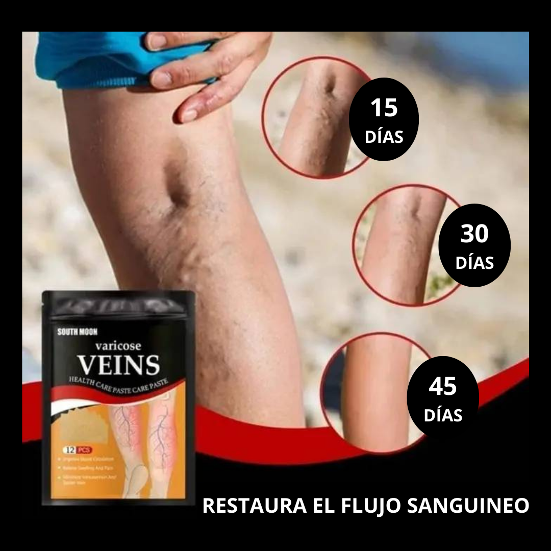 Parches para Varices