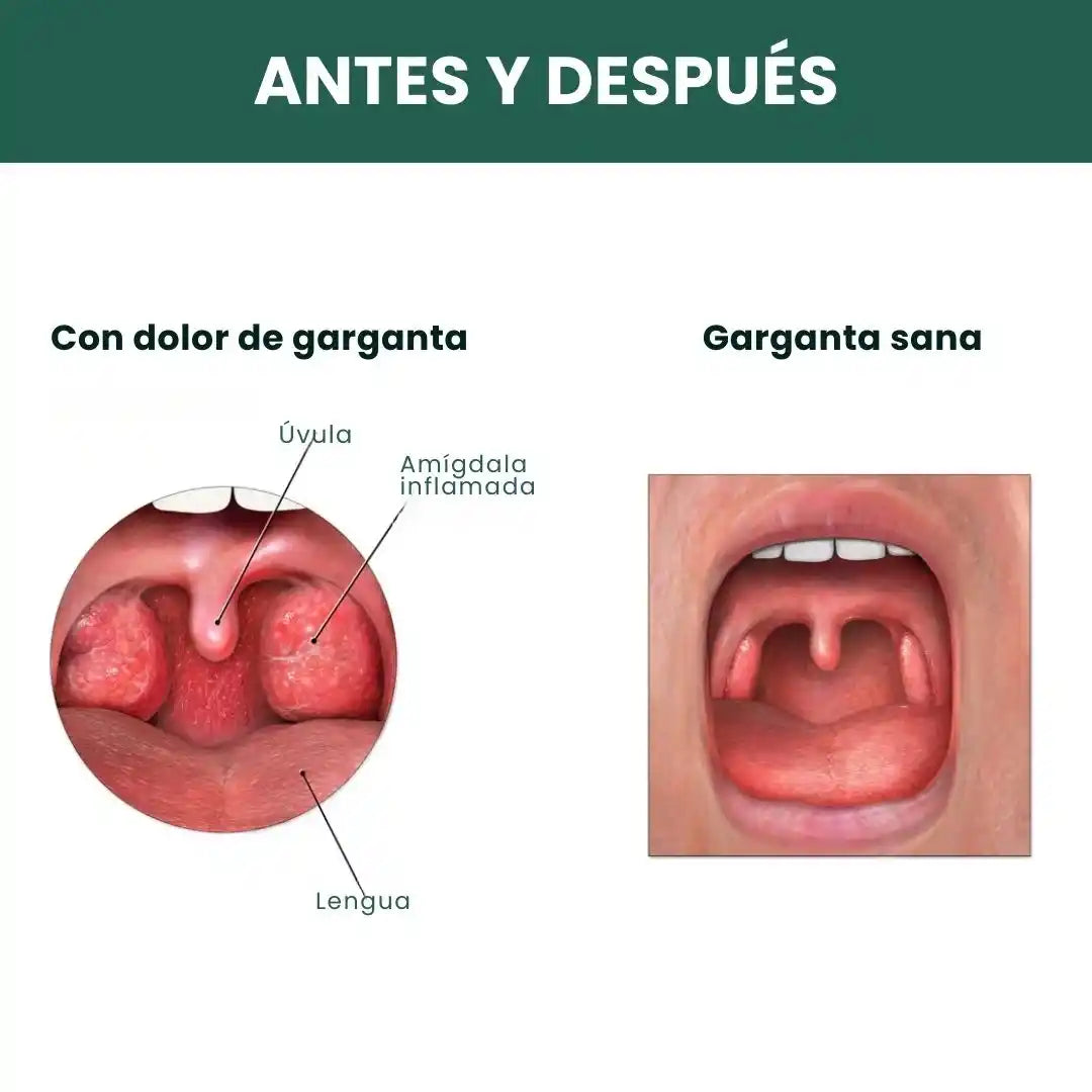 THROAT PATCH: el secreto para una garganta sana, fresca y sin irritación 🔥🌿