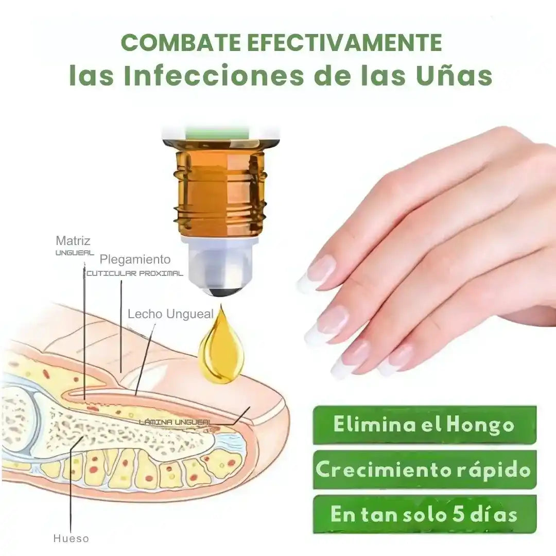 UÑA VITAL: el secreto para uñas fuertes, perfectas y sin hongos💅✨