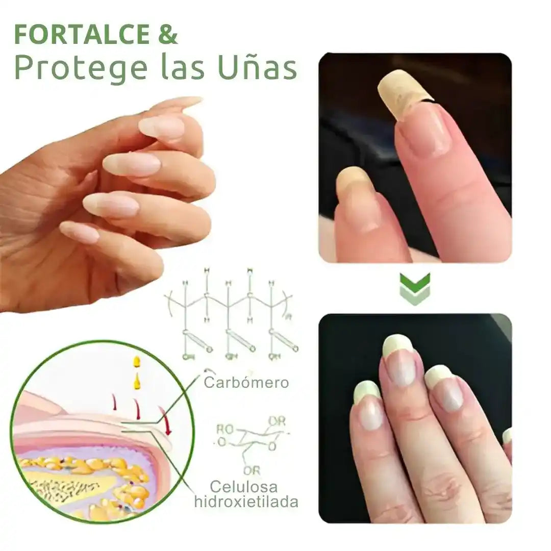 UÑA VITAL: el secreto para uñas fuertes, perfectas y sin hongos💅✨